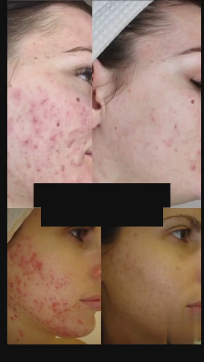 LED Face Mask – Anti-Aging & Radiant Skin Care